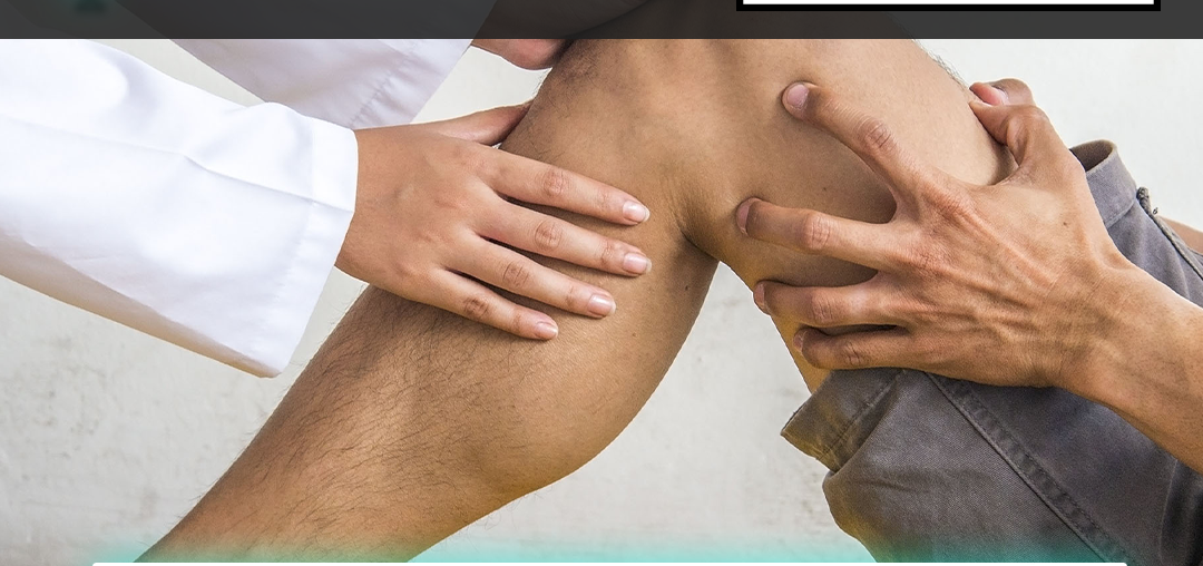 Como saber se a lesão no joelho é grave?